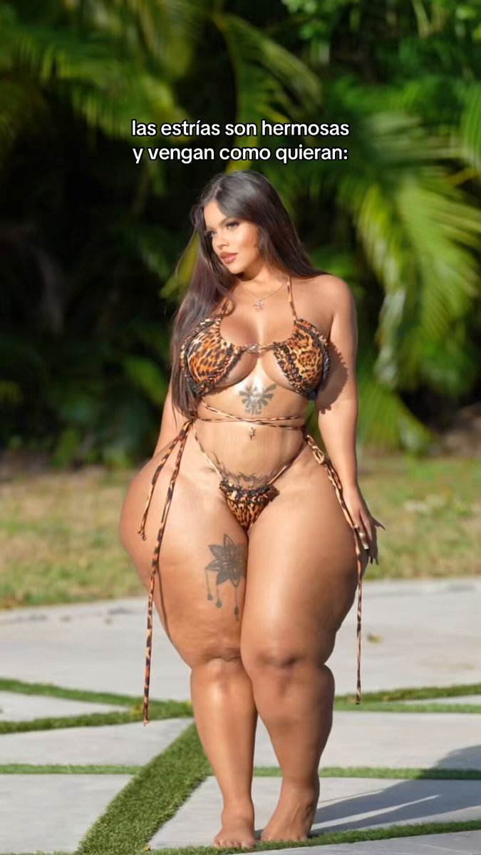 stretch marks are beautiful